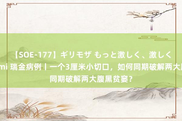 【SOE-177】ギリモザ もっと激しく、激しく突いて Ami 瑞金病例丨一个3厘米小切口，如何同期破解两大腹黑贫窭？
